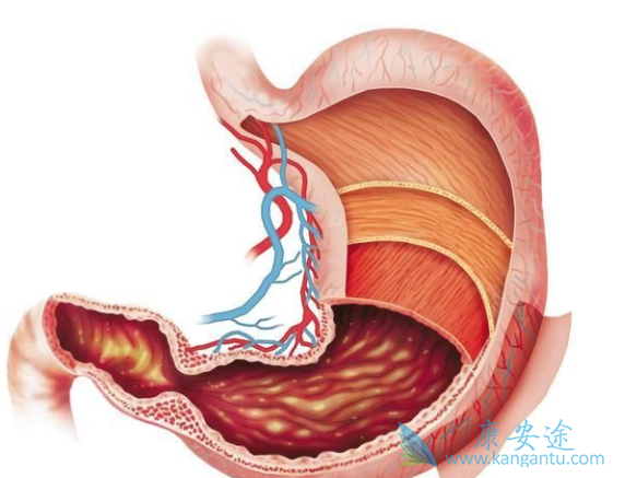 胃癌肝转移 胃癌肝转移