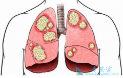 �����������Ʒΰ��ٰ���ҩ����ô�죿