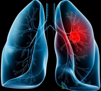 ���ݷΰ���ת��֢״���жϲ�������س̶�