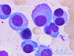 �෢�Թ�����֢״��Ҫ��������Щ���棿