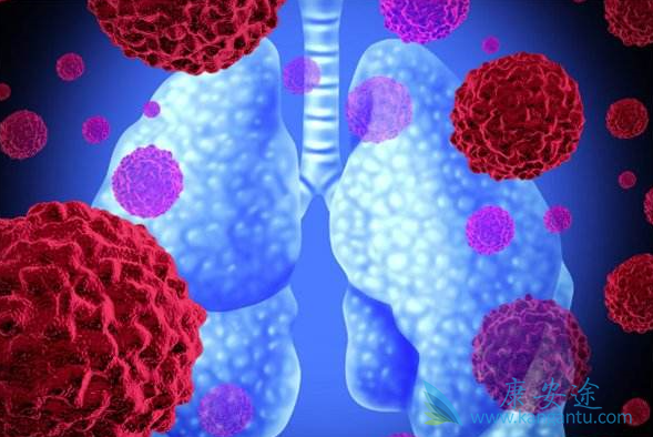 特发性肺纤维化 特发性肺纤维化
