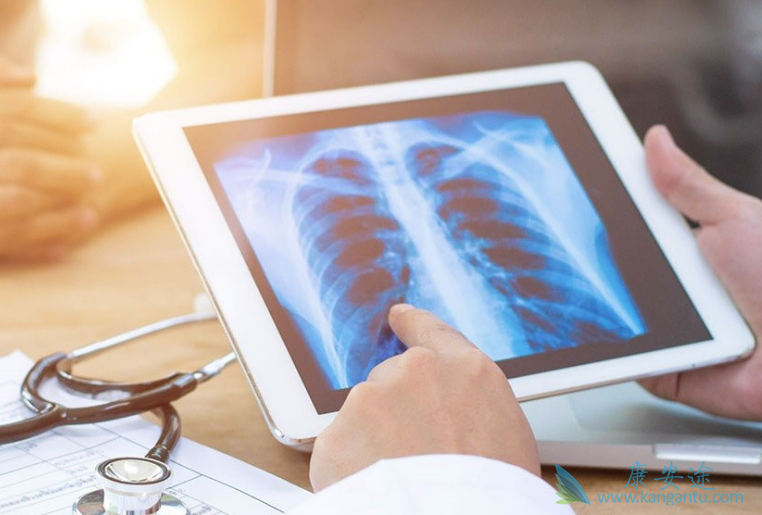 肺癌晚期怎么治疗 肺癌晚期怎么治疗