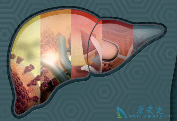 慢性丙肝的症状 慢性丙肝的症状