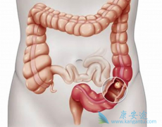 ���������ڽ�ֱ������������Щ���ã�