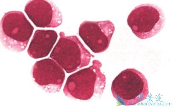 白血病前兆 白血病前兆
