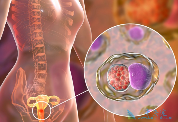宫颈癌症状 宫颈癌症状
