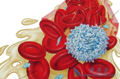 ������Щ֢״����˵���㻼����������ϸ����Ѫ����