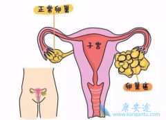 �ѳ���������ʲô���ѳ���������֢״����Щ��