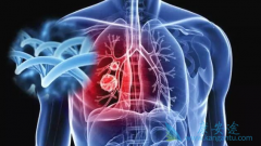 EGFR-TKI����������������Ч����Ӱ��