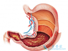 ����θ���ܻ��ã�����Щθ������֢״��