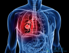 �ΰ�����Ч��������ν�����������Ч��������