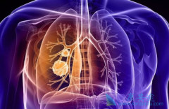 ���ڷΰ����ߵķ��Ӱ������ƺͻ���