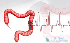 ߻��������Ϊ��ֱ���������Ƶ�����ѡ�񷽰�