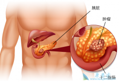 ��Щ���ػ�����ٰ������ܻ��ò���Ӱ�죿