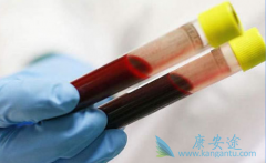 �Ҹ�e����������ʲô��˼���Ҹ�e�������Ը���ô�죿