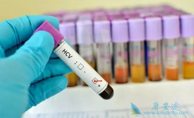 治疗丙肝 治疗丙肝