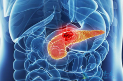 ���ٰ�֢״�ѷ��ֺ����ٰ���������Ч���������ʵ͵���Ҫԭ��