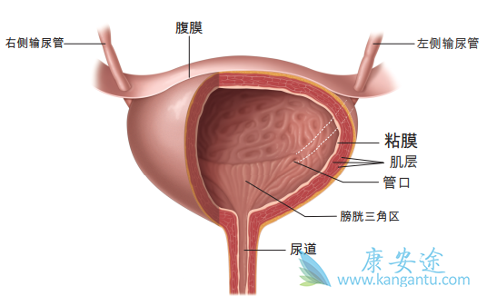 膀胱癌的治疗方法 膀胱癌的治疗方法