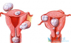 ע��������������ǲ��ǾͲ���׻���������