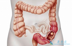 ��ֱ�������ٰ�Ӧ�����ɸ�飿�������ɸ���ֱ�������ߣ�