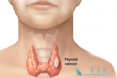 ��״�ٽ���Ǽ�״�ٰ�������֢״��