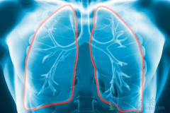 ����ά���Ĳ�������Щ������᲼���ӻ�������