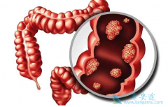 ߻���������ڽ�ֱ��������Щ�洦��