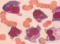 �෢�Թ�����֢״���ָ��Ӷ��ȱ��������