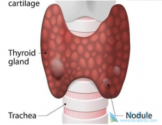 �շ���״�������Ĳ�������Щ��