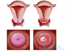 ���������ڻ򸴷����������Ƶķ��Ӱ���ҩ������Щ��