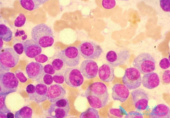 �ÿ����������ƶ෢�Թ�����ӦС����Ѫ�ܲ����¼�