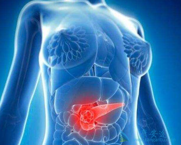 胰腺癌 胰腺癌