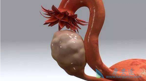 海外医疗 海外医疗