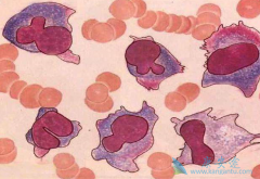 ��ʹ���ٴ��г�������Ķ෢�Թ�����֢״