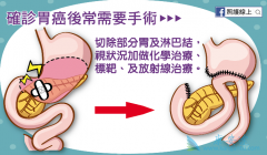 PARP���Ƽ�Fluzoparib��������θ��������