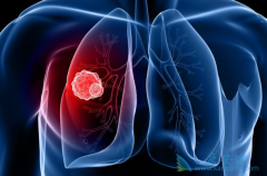 �������������EGFR-TKI��ȸ���������ʲô��ͬ��