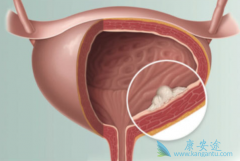 ����ҽ�Ʒ����յ����װ�������ԭ������Щ