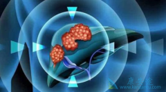 �Ҹ�������ʹ��TAF�����ΰ����ս�TDF�Ͷ��濨Τ��