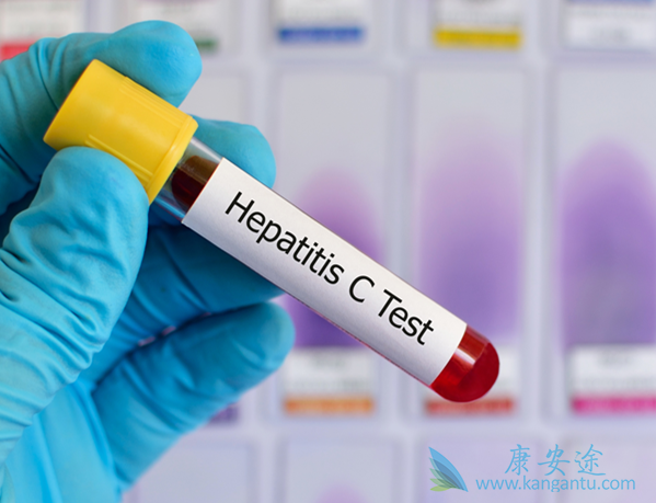 丙肝窗口期 丙肝窗口期