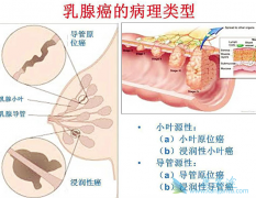 ���������ٰ��������׳���ת����