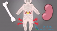 ����ʹ��˫������(zometa)�Թǹؽ��׵ķ�������һ����������