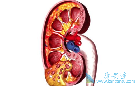 肾癌晚期 肾癌晚期