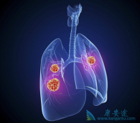 �ΰ���ת�Ƶ�֢״���ֺͰ������ƽ�չ