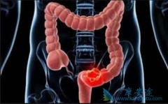 ߻�������Ϊ���ڽ�ֱ�����������Ʊ�׼��ҩ����Ч��Σ�