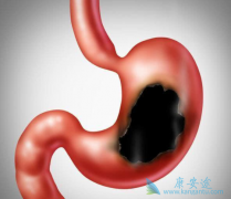 �����鵥������θ����ʲôҪ��