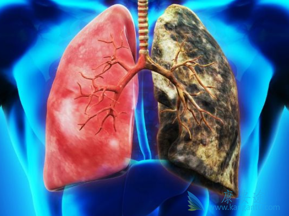 肺癌肝转移 肺癌肝转移