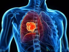 ����EGFRͻ��ķΰ�ҩ������Щ������θ�ҩ��