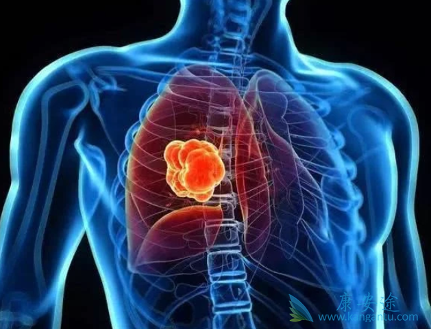 肺癌药物 肺癌药物