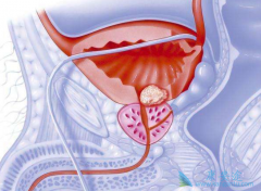 ���̻�Ӱ�������ǰ���ٰ����Ƶ�Ԥ�����������