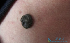 ���������������޷������ƺ�ɫ�������ٴ�Ч����Σ�